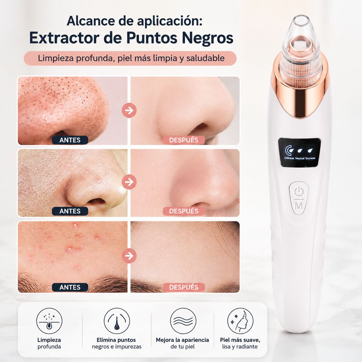 BELLA CLEANER | EXTRACTOR PROFESIONAL DE PUNTOS NEGROS Y ESPINILLAS