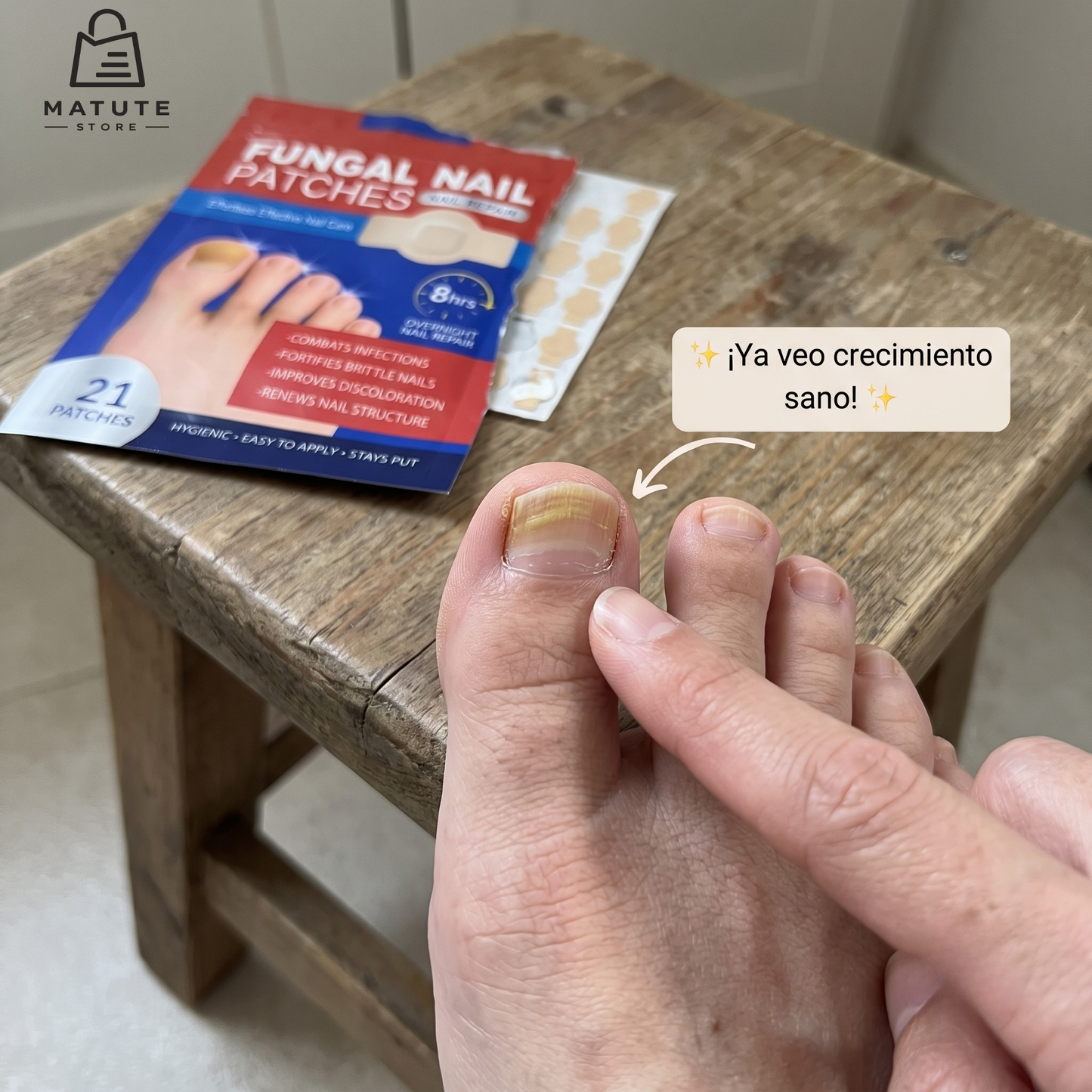 STOCK LIMITADO - Parche Anti Hongo FUNGAL NAIL