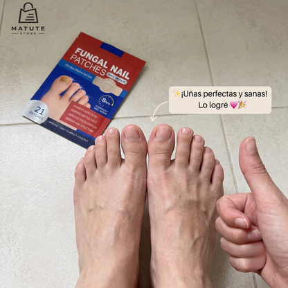 STOCK LIMITADO - Parche Anti Hongo FUNGAL NAIL