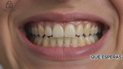 Carillas Postiza Dentadura SnapOn Smile