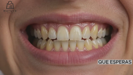 Carillas Postiza Dentadura SnapOn Smile