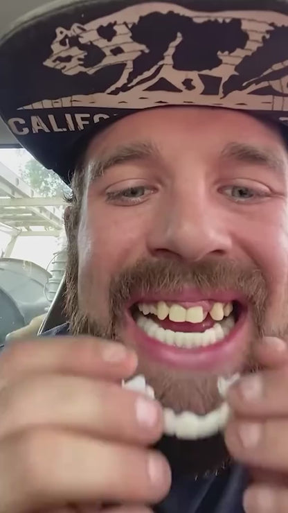 Carillas Postiza Dentadura SnapOn Smile